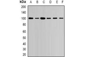 Western blot analysis of USP16 expression in Jurkat (A), NIH3T3 (B), COS7 (C), mouse heart (D), mouse spleen (E), rat brain (F) whole cell lysates. (USP16 Antikörper)