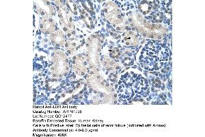 Rabbit Anti-LOR Antibody  Paraffin Embedded Tissue: Human Kidney Cellular Data: Epithelial cells of renal tubule Antibody Concentration: 4. (LOR Antikörper  (N-Term))
