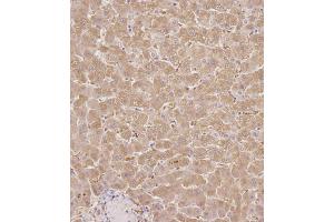 Immunohistochemistry (Paraffin-embedded Sections) (IHC (p)) image for anti-serpin Peptidase Inhibitor, Clade A (Alpha-1 Antiproteinase, Antitrypsin), Member 6 (SERPINA6) (AA 197-225) antibody (ABIN654693)