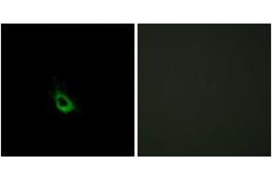 Immunofluorescence analysis of HeLa cells, using CARD10 Antibody.