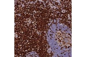 Immunohistochemical staining of human tonsil with FYB polyclonal antibody ( Cat # PAB28030 ) shows strong cytoplasmic positivity at 1:50 - 1:200 dilution.