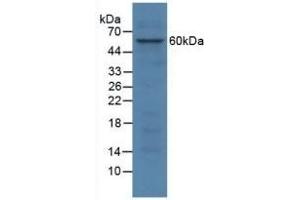 Detection of SGSH in Human HepG2 Cells using Polyclonal Antibody to N-Sulfoglucosamine Sulfohydrolase (SGSH) (SGSH Antikörper  (AA 21-389))