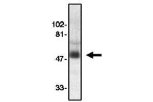 Image no. 1 for anti-Chemokine (C-C Motif) Receptor 8 (CCR8) (AA 183-201), (Extracellular Loop) antibody (ABIN265001) (CCR8 Antikörper  (Extracellular Loop))