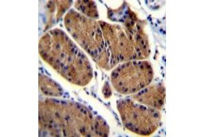 Immunohistochemistry (Paraffin-embedded Sections) (IHC (p)) image for anti-NADH Dehydrogenase (Ubiquinone) Fe-S Protein 8, 23kDa (NADH-Coenzyme Q Reductase) (NDUFS8) (Middle Region) antibody (ABIN953637)