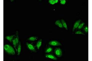 Immunofluorescence (IF) image for anti-ATP-Binding Cassette, Sub-Family C (CFTR/MRP), Member 4 (ABCC4) (AA 562-697) antibody (ABIN7160314)