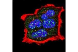 Immunofluorescence (IF) image for anti-Tuberous Sclerosis 2 (TSC2) (pSer1420) antibody (ABIN3029326)