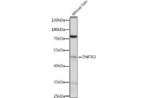 ZNF763 Antikörper  (AA 315-370)