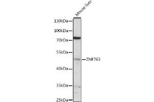 Western blot analysis of extracts of various cell lines, using ZNF763 antibody (ABIN7271529) at 1:1000 dilution. (ZNF763 Antikörper  (AA 315-370))