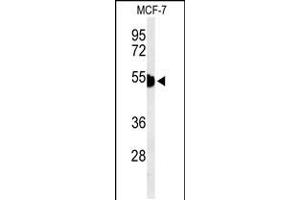 Western blot analysis of KRT1 Antibody in MCF-7 cell line lysates (35ug/lane) (Cytokeratin 1 Antikörper  (AA 415-443))