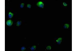 Immunofluorescence staining of MCF-7 cells with ABIN7140114 at 1:50, counter-stained with DAPI. (RTN4RL2 Antikörper  (AA 355-372))