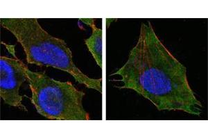 Confocal immunofluorescence analysis of Hela (left) and L-02 (right) cells using S100A10/P11 antibody (green). (S100A10 Antikörper)