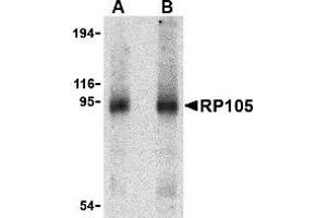 Western Blotting (WB) image for anti-CD180 Molecule (CD180) (Middle Region) antibody (ABIN1031073) (CD180 Antikörper  (Middle Region))