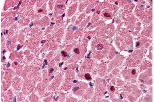 Image no. 1 for anti-Purinergic Receptor P2X, Ligand-Gated Ion Channel, 6 (P2RX6) (AA 66-115) antibody (ABIN6735763)