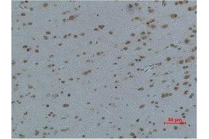 Immunohistochemical analysis of paraffin-embedded Rat Brain Tissue using L-type Ca++ CP γ4 Polyclonal Antibody. (CACNG4 Antikörper)