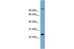 WB Suggested Anti-SEMA3D Antibody Titration: 0. (SEMA3D Antikörper  (Middle Region))