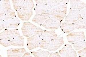 Immunohistochemistry (Paraffin-embedded Sections) (IHC (p)) image for anti-T-Box 10 (TBX10) antibody (ABIN7075814)