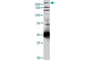 TLN1 monoclonal antibody (M05), clone 5C1. (TLN1 Antikörper  (AA 1052-1149))
