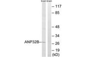 Western blot analysis of extracts from rat brain cells, using ANP32B Antibody. (ANP32B Antikörper  (AA 1-50))