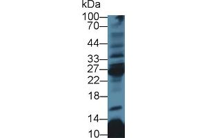 Western blot analysis of Rat Thymus lysate, using Human CD8b Antibody (3 µg/ml) and HRP-conjugated Goat Anti-Rabbit antibody ( (CD8B Antikörper  (AA 22-170))