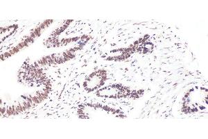 Immunohistochemistry (Paraffin-embedded Sections) (IHC (p)) image for anti-B-Cell CLL/lymphoma 9 (BCL9) antibody (ABIN7262729)