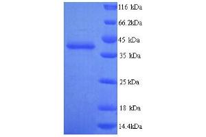 TLN2 Protein (AA 88-406) (His tag)