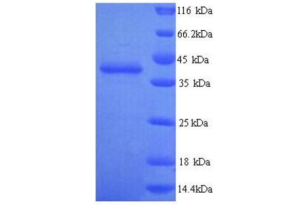 TLN2 Protein (AA 88-406) (His tag)