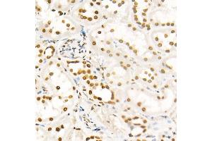 Immunohistochemistry of paraffin-embedded rat ovary using H4K8ac antibody (ABIN7267747) at dilution of 1:100 (40x lens). (Histone H4 Antikörper  (acLys8))