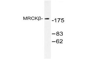 Western blot (WB) analysis of MRCKβ antibody in extracts from COLO cell.