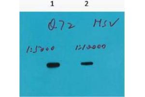 Western Blotting (WB) image for anti-HSV Tag antibody (ABIN3181183) (HSV Tag Antikörper)