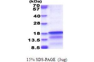 SDS-PAGE (SDS) image for Hepatitis C Virus Core Protein (HCV C) (AA 1-120) protein (His tag) (ABIN5853816)