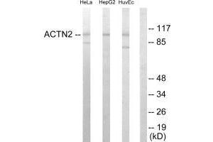 ACTN3 Antikörper  (N-Term)