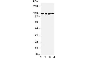 Western blot testing of SERCA2 ATPase antibody and Lane 1:  rat skeletal muscle;  2: rat kidney;  3: human PANC;  4: SMMC-7721 cell lysate. (SERCA2 ATPase (Middle Region) Antikörper)
