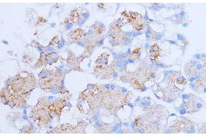 Immunohistochemistry of paraffin-embedded Rat pancreas using NME6 Polyclonal Antibody at dilution of 1:100 (40x lens). (NME6 Antikörper)