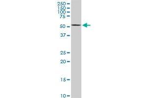 Western Blotting (WB) image for anti-V-Akt Murine Thymoma Viral Oncogene Homolog 2 (AKT2) (AA 100-189) antibody (ABIN599349) (AKT2 Antikörper  (AA 100-189))