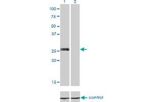 Western blot analysis of MYOG over-expressed 293 cell line, cotransfected with MYOG Validated Chimera RNAi (Lane 2) or non-transfected control (Lane 1).
