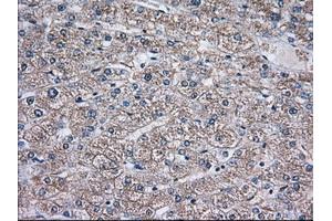 Immunohistochemical staining of paraffin-embedded Human liver tissue using anti-TBXAS1 mouse monoclonal antibody. (TBXAS1 Antikörper)