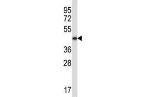 Western Blotting (WB) image for anti-Bone Morphogenetic Protein 2 (BMP2) (AA 260-289) antibody (ABIN3028512)
