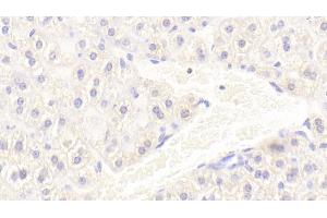 Immunohistochemistry (IHC) image for anti-Ionized Calcium-binding Adapter Molecule 1 (IBA1) (AA 35-102) antibody (ABIN7434800)