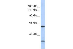 WB Suggested Anti-ZNF777 Antibody Titration:  0. (ZNF777 Antikörper  (N-Term))
