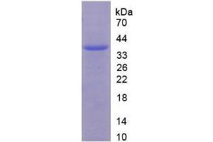 SDS-PAGE analysis of Human Androgen Receptor Protein. (Androgen Receptor Protein (AR) (AA 15-246) (His-GST))