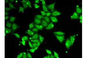 Immunofluorescence analysis of HeLa cells using ATXN3 antibody. (Ataxin 3 Antikörper)