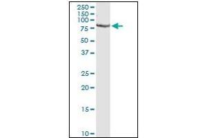 Western Blotting (WB) image for anti-Proprotein Convertase Subtilisin/kexin Type 1 (PCSK1) (AA 652-754) antibody (ABIN781869) (PCSK1 Antikörper  (AA 652-754))