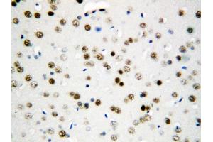 Immunohistochemistry (IHC) image for anti-Apoptosis Inhibitor 5 (API5) (AA 487-504), (C-Term) antibody (ABIN3044316)