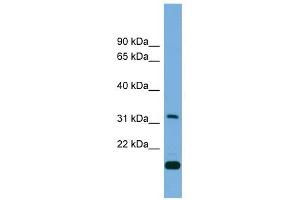 CTDSP2 antibody used at 1 ug/ml to detect target protein.