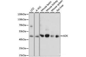 Western blot analysis of extracts of various cell lines using ADK Polyclonal Antibody at dilution of 1:1000. (ADK Antikörper)
