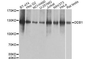 Western blot analysis of extracts of various cell lines, using DDB1 Antibody. (DDB1 Antikörper  (C-Term))