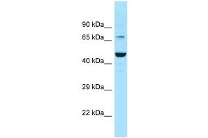Western Blotting (WB) image for anti-Solute Carrier Family 6 (Neurotransmitter Transporter, GABA), Member 11 (SLC6A11) (C-Term) antibody (ABIN2788129) (SLC6A11 Antikörper  (C-Term))