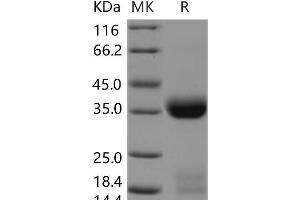 Western Blotting (WB) image for Kallikrein 1 (KLK1) (Active) protein (His tag) (ABIN7196656) (Kallikrein 1 Protein (KLK1) (His tag))