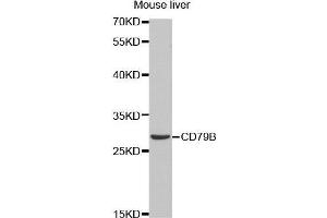 Western Blotting (WB) image for anti-CD79b Molecule, Immunoglobulin-Associated beta (CD79B) (AA 29-159) antibody (ABIN6219206) (CD79b Antikörper  (AA 29-159))