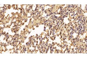 Detection of IFNa2 in Rat Lung Tissue using Polyclonal Antibody to Interferon Alpha 2 (IFNa2) (IFNA2 Antikörper  (AA 24-188))